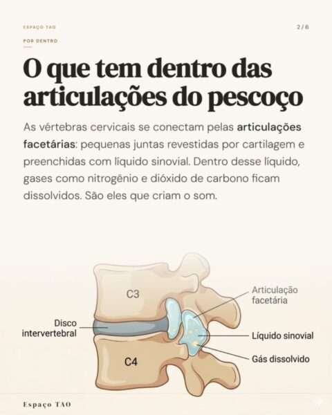 Ilustração das vértebras C3 e C4 mostrando a articulação facetária com líquido sinovial e gás dissolvido, origem dos estalos da quiropraxia